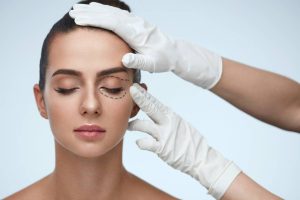 Common Questions about Lower Blepharoplasty