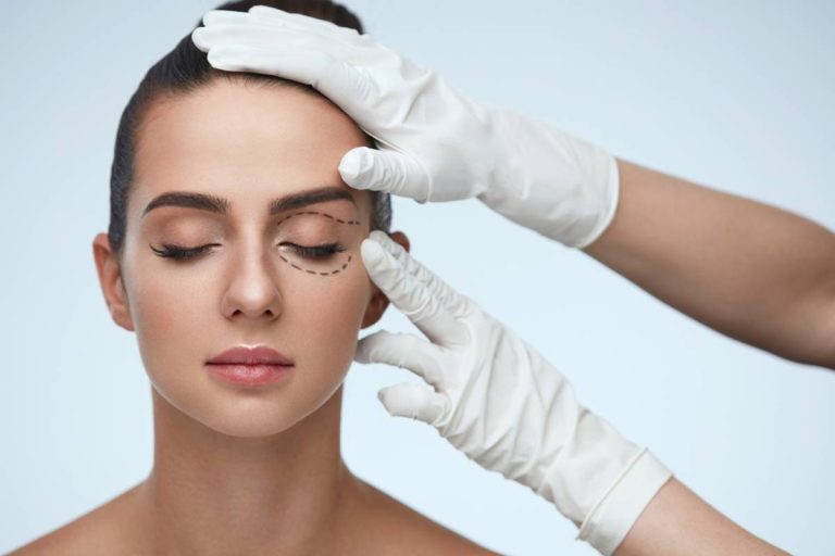 Common Questions about Lower Blepharoplasty