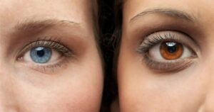 How keratopigmentation Is Transforming Modern Cosmetic Ophthalmology